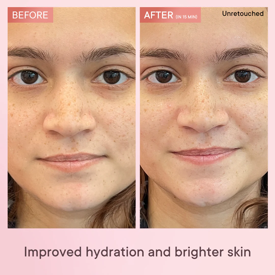 Brightening & Skin Clarifying Sheet Mask with Cherry Blossom Radiance - 25 ML - Pack Of 1 - Image 3