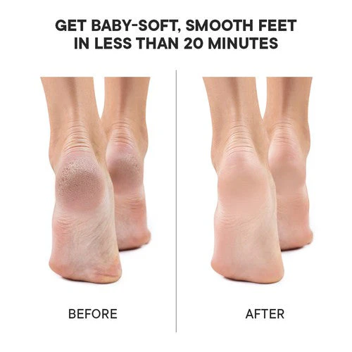Pedicure Foot Mask with Matcha Green Tea (Pack of 1) - Image 6