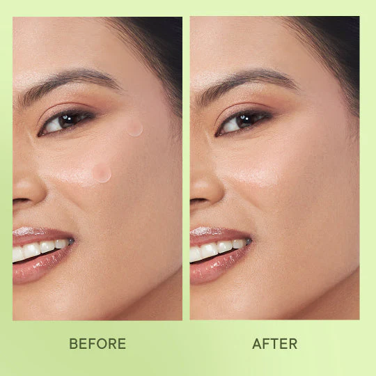 Zit Away Treatment Patches with Cica Herb Repair - 24 PATCHES - Image 4